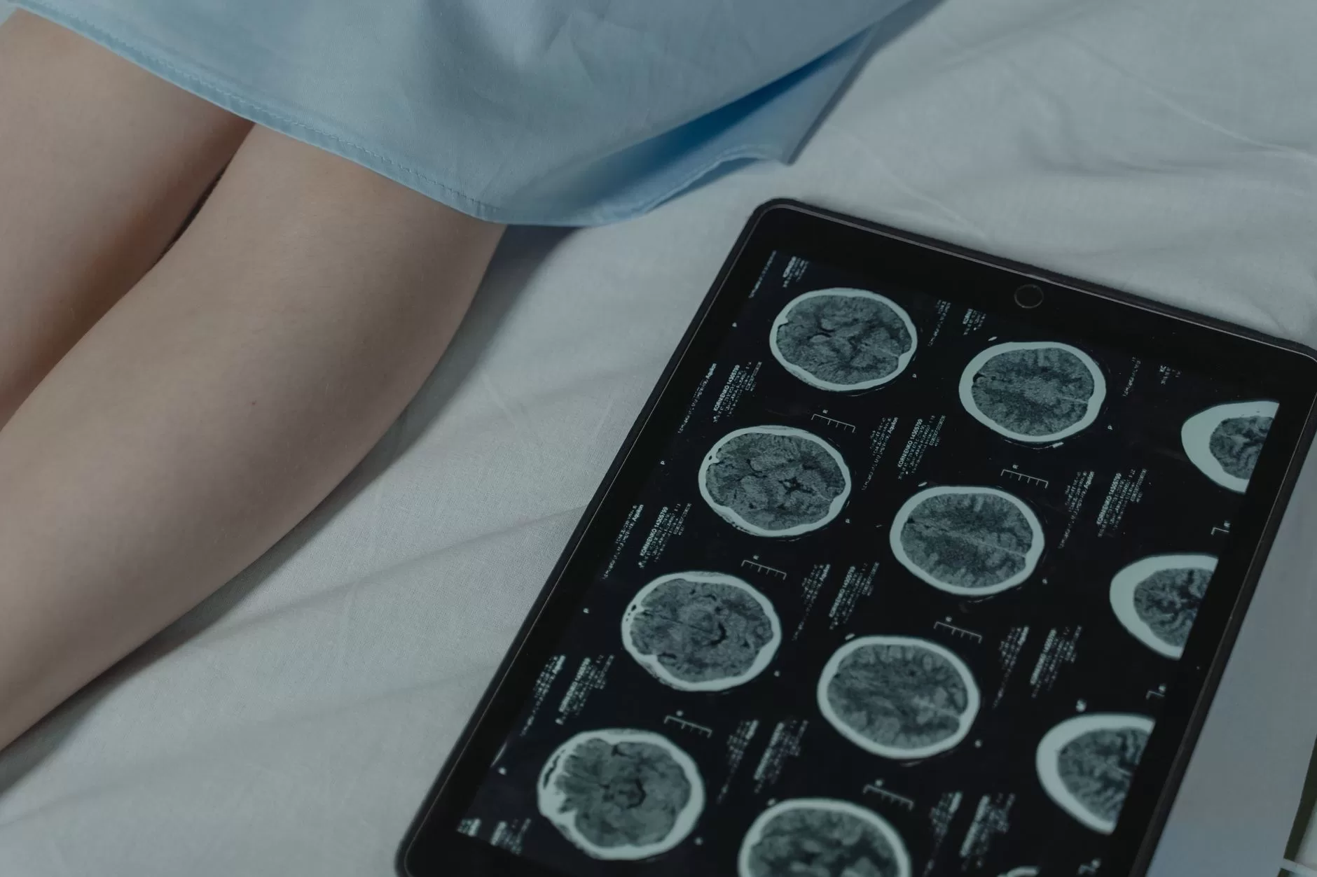 ADHD Diagnosis