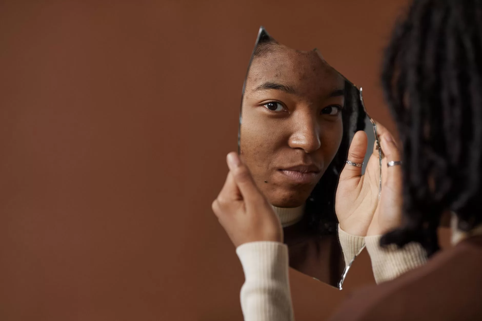Acne in Adolescents
